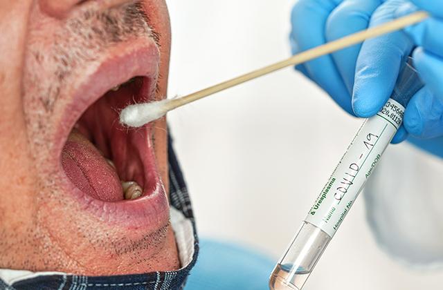 CVID-19 Mouth swab